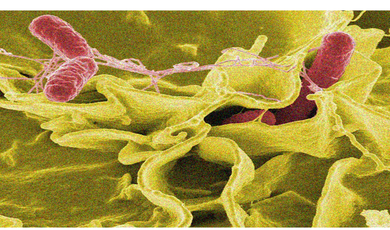 Des bactéries roses flottent dans un milieu ressemblant à un bain intercellulaire, visible sur la photo.